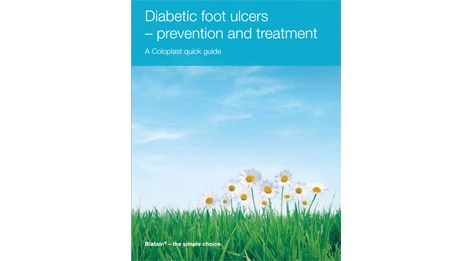 Úlceras de pie diabético: prevención y tratamiento  