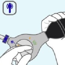 Introducción de la sonda paso 1 Introducción de la sonda paso 1